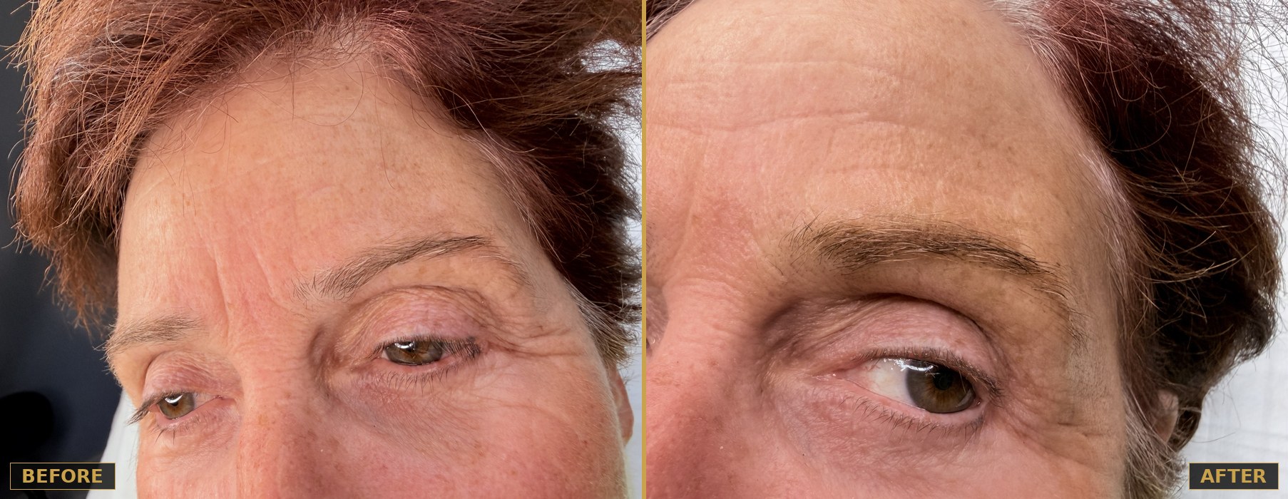 Before and after brow enhancement, ombré powder technique