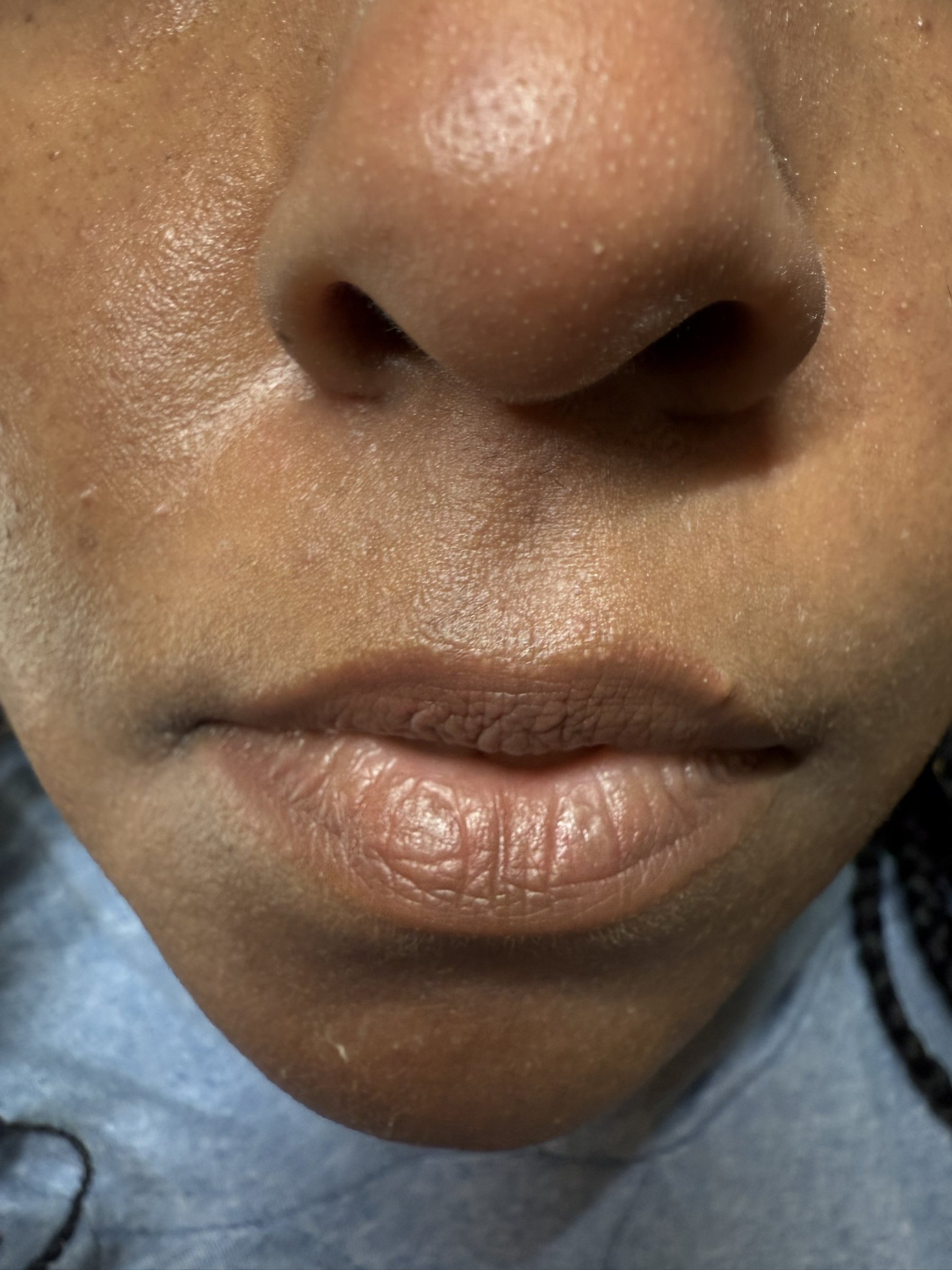 Healed lip blush result