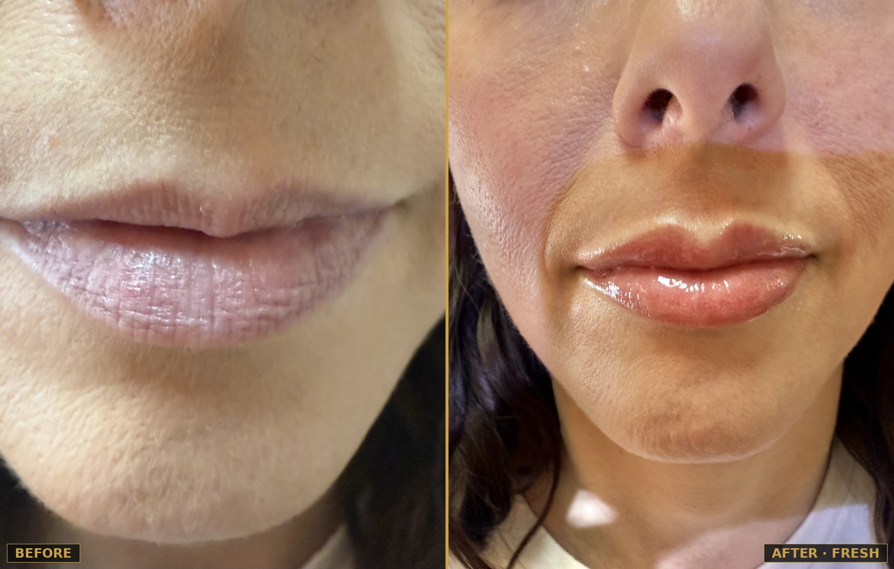 Before and after lip blush permanent makeup, fresh result